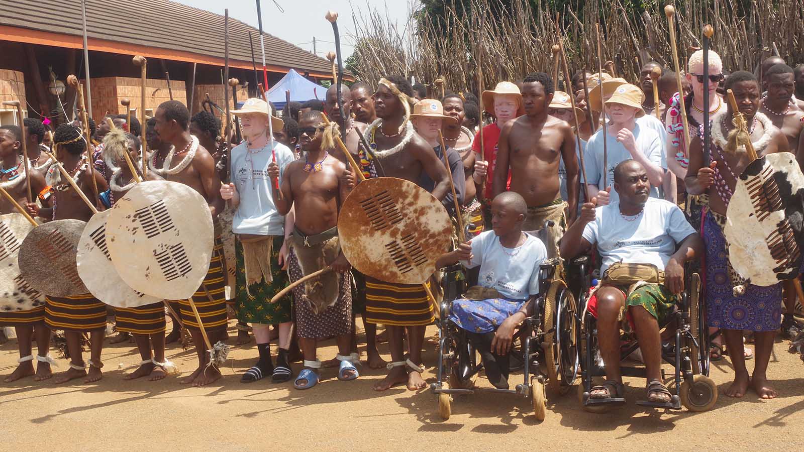 Cultural leadership confronts albinism discrimination head-on
